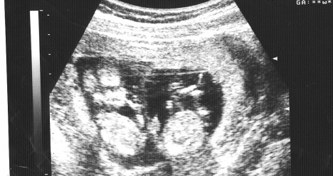 Моя беременность в 2013 году.