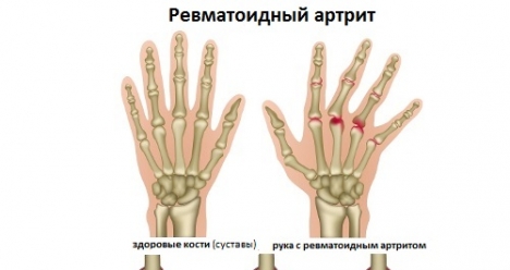 Выздоровление моей матери