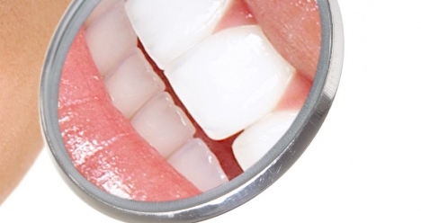 Красивые здоровые зубы