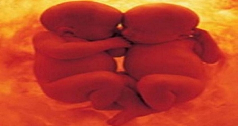 хочу родить двойняшек